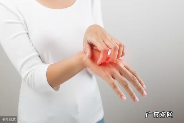 皮炎图片和症状 脸上过敏性皮炎图片和症状