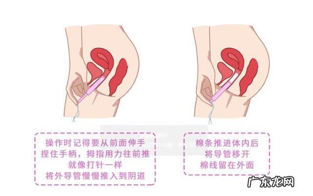 女性生殖系统的结构组成图解 女性的3个孔