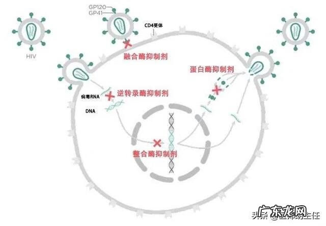 女人艾滋病最明显特征 女人艾滋病的三大症状图片大全