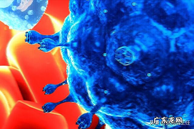 女人艾滋病最明显特征 女人艾滋病的三大症状图片大全