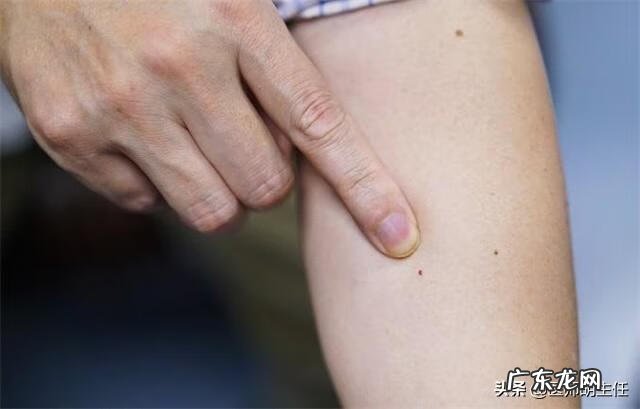 女人艾滋病最明显特征 女人艾滋病的三大症状图片大全