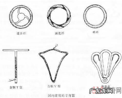 节育环图片大全片 型号 节育环的图片大全