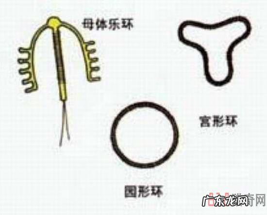 节育环图片大全片 型号 节育环的图片大全