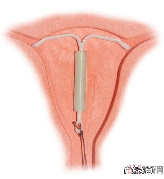 节育环图片大全片 型号 节育环的图片大全