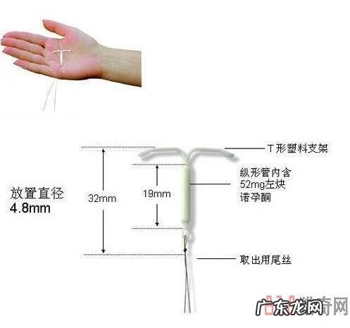 节育环图片大全片 型号 节育环的图片大全