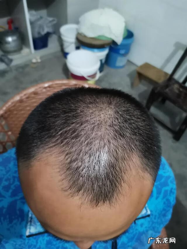 不用洗发水有什么好处 不用洗发水洗头对头发好吗