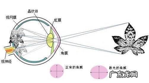 眼睛散光是什么情况 眼睛散光是怎么回事