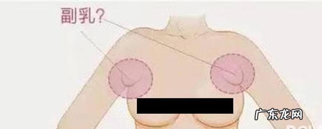 怎么判断是否有副乳 到底什么是副乳