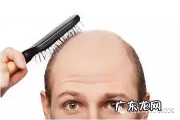 头发稀少怎么办 前面头顶头发稀少怎么办