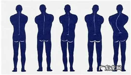 如何确定是不是强直性脊柱炎 强制性脊柱炎