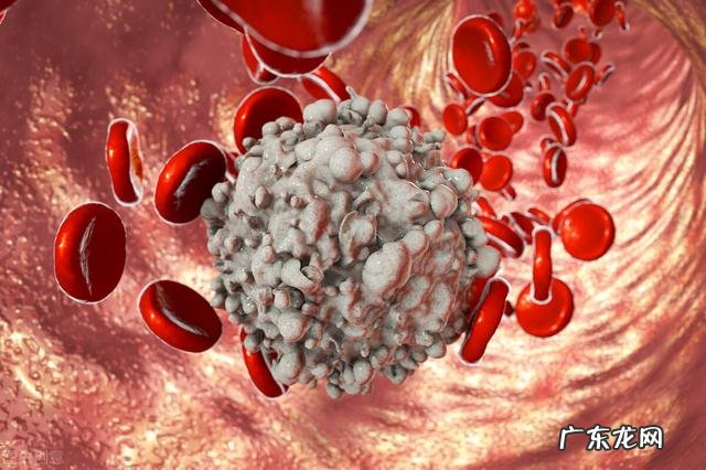 白血病的病因及发病机制 慢性白血病的病因