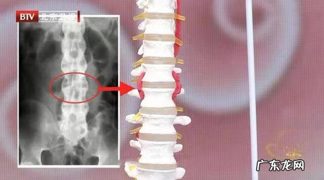 无缘无故背痛是怎么回事 早上起来背痛是怎么回事