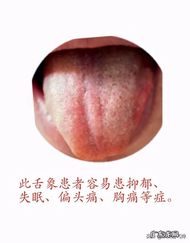 舌头上长很多红点 舌头上有很多小红点点