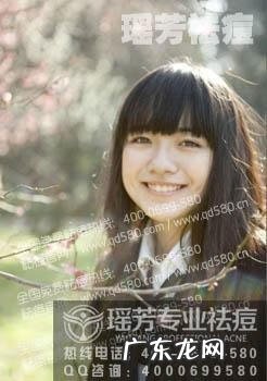 去哪家祛痘好 祛痘哪家好