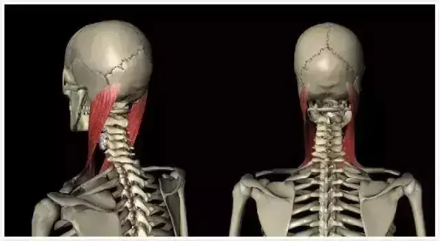 胸锁乳突肌在哪个位置 胸锁乳突肌位置