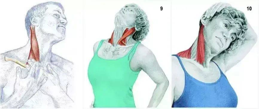 胸锁乳突肌在哪个位置 胸锁乳突肌位置