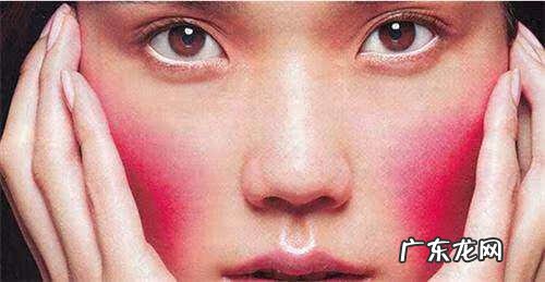 怎么样才能把脸上的红血丝去掉 脸上的红血丝怎样去掉