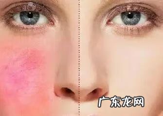 有什么办法去红血丝 去红血丝的方法有什么
