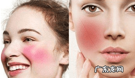 有什么办法去红血丝 去红血丝的方法有什么