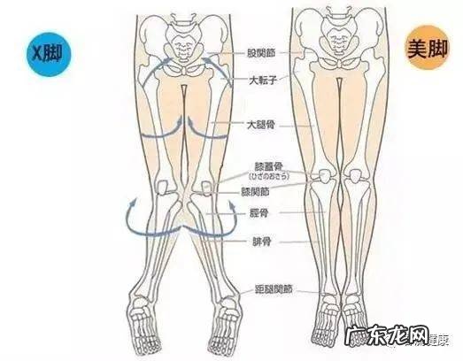 小谈X型腿的成因及预防