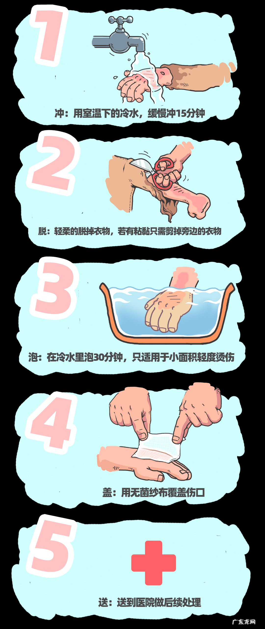 烫伤处理步骤 烫伤处理方法正确的是