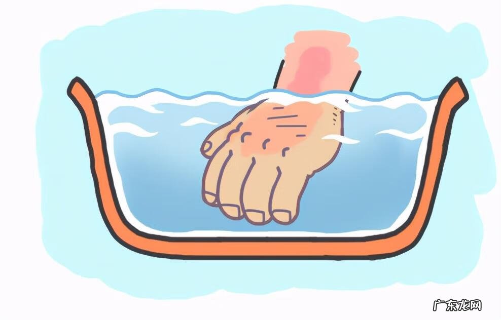 烫伤处理步骤 烫伤处理方法正确的是