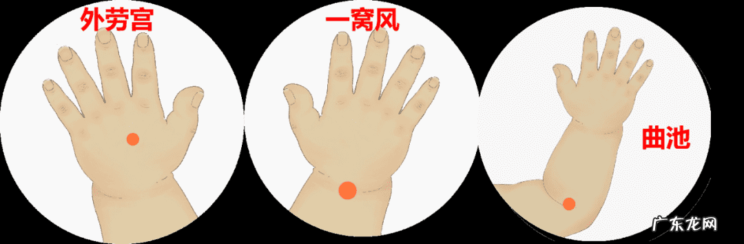 小儿湿疹的中医调理和养护