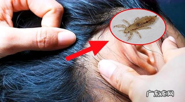 特别脏如果不及时处理会怎么样 人身上最脏的地方是哪里