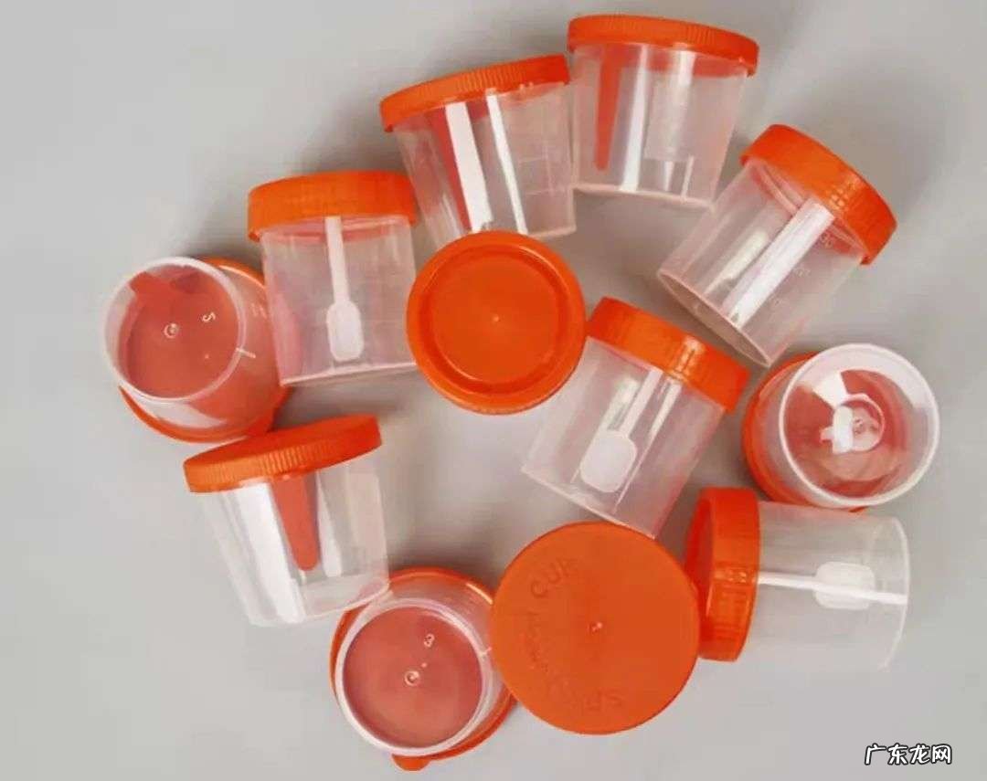 粪便检查有什么作用?怎么做?有哪些注意事项?