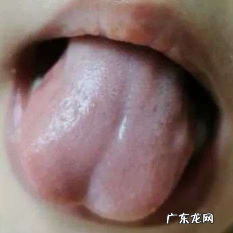 藿香正气水和保济口服液有什么区别