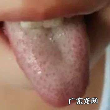 藿香正气水和保济口服液有什么区别