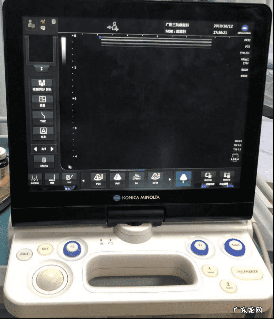 得了膝关节炎怎么办？