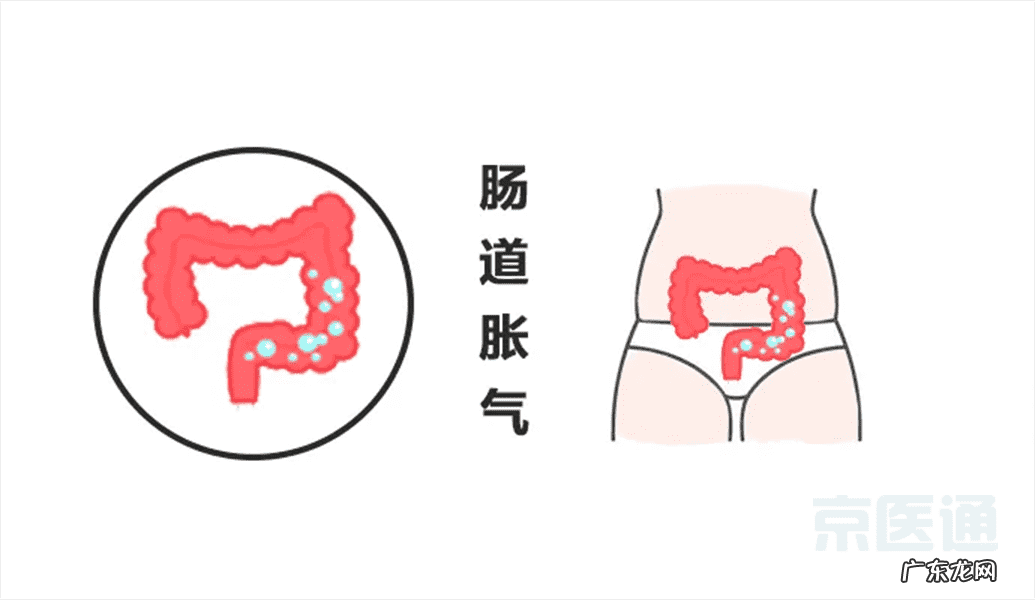 肚子为什么会胀气?如何缓解胃肠胀气?