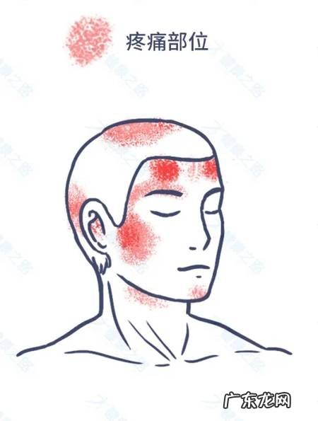 有效缓解头痛的“颈椎操”