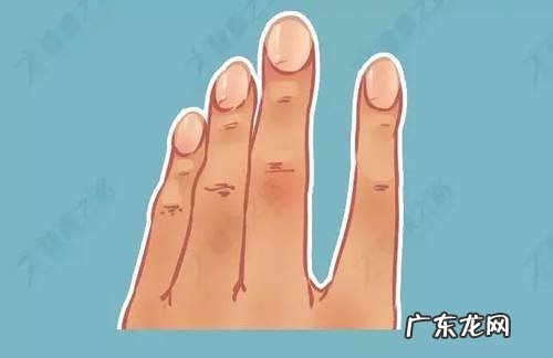 杵状指的辨别、就医检查及预防