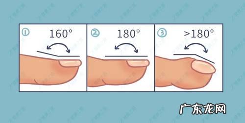 杵状指的辨别、就医检查及预防
