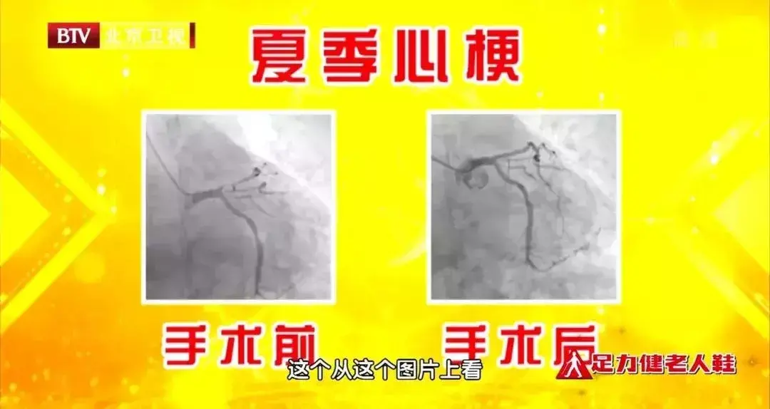 含钾高的食物一览表图片 水果含钾高的食物一览表