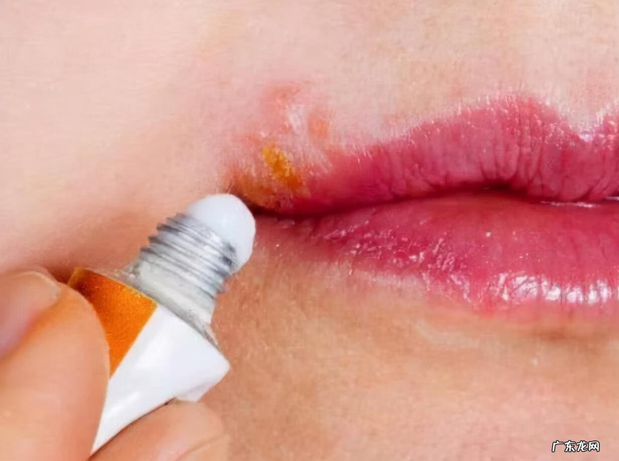 红霉素软膏的十大功效 红霉素软膏的作用及功能主治