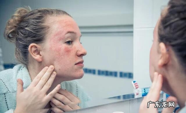 红霉素软膏的十大功效 红霉素软膏的作用及功能主治