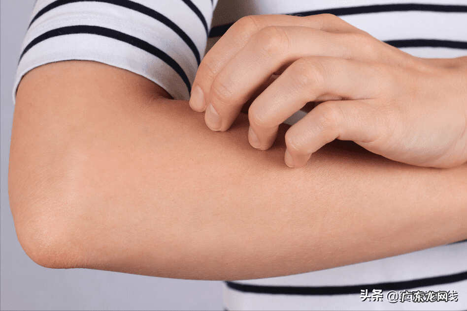 一招判断艾滋病小红点 艾滋检测结果怎么看