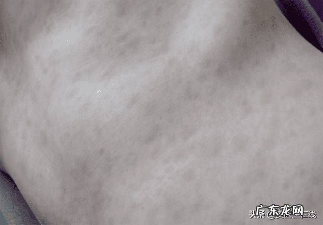 一招判断艾滋病小红点 艾滋检测结果怎么看