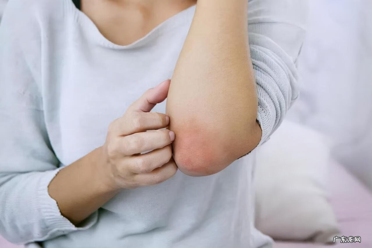 血糖高有哪些症状表现出来 血糖高的症状表现有哪些症状