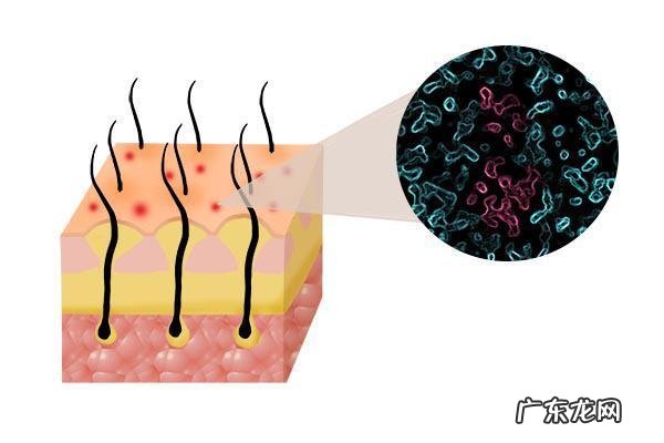 头长了红色疙瘩 头皮起红疙瘩是怎么回事