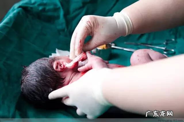 剖腹产全过程图解 剖腹产全过程的图片