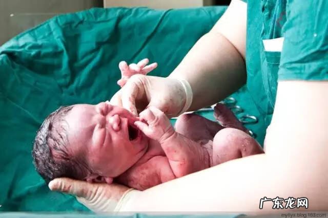 剖腹产全过程图解 剖腹产全过程的图片