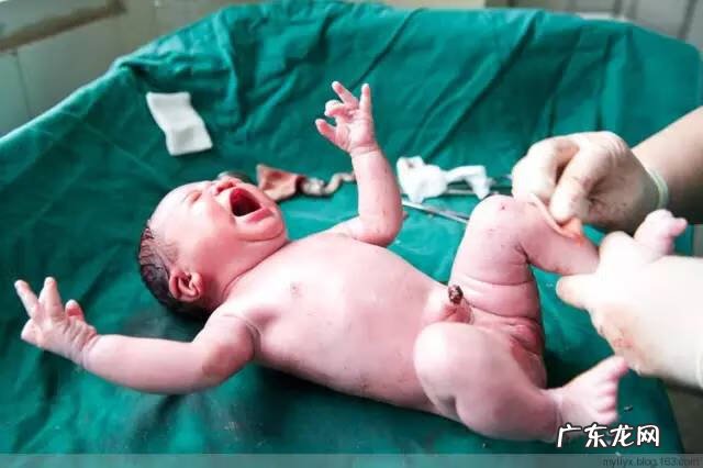 剖腹产全过程图解 剖腹产全过程的图片