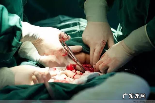 剖腹产全过程图解 剖腹产全过程的图片