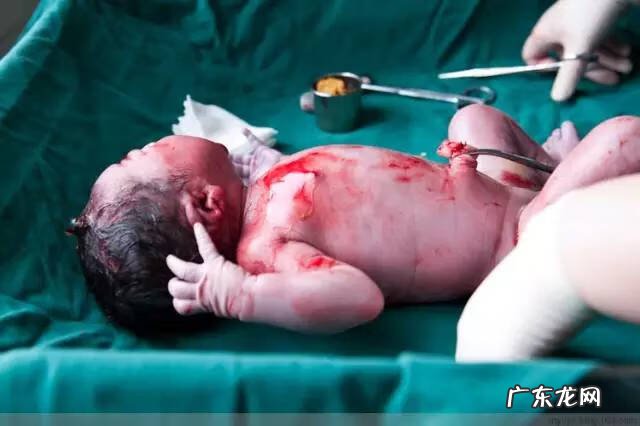 剖腹产全过程图解 剖腹产全过程的图片