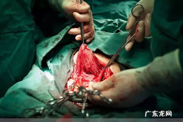 剖腹产全过程图解 剖腹产全过程的图片