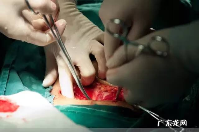 剖腹产全过程图解 剖腹产全过程的图片